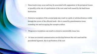 • Sinus tract(s) may occur and may be associated with suppuration in the periapical tissues
or possibly at the site of a perforation of the root canal wall caused by the hard tissue
destruction.
• Extensive resorption of the coronal pulp may result in a pink or red discoloration visible
through the crown of the affected tooth - this is caused by granulomatous tissue
extending into and occupying the resorptive defect
• Progressive resorptions can result in extensive unrestorable tissue loss.
• At times an external communication can develop between the root canal and the
periodontal ligament, due to perforation of the root
 