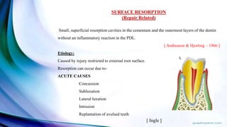 SURFACE RESORPTION
(Repair Related)
Small, superficial resorption cavities in the cementum and the outermost layers of the dentin
without an inflammatory reaction in the PDL.
[ Andreason & Hjorting – 1966 ]
Etiology:
Caused by injury restricted to external root surface.
Resorption can occur due to-
ACUTE CAUSES
Concussion
Subluxation
Lateral luxation
Intrusion
Replantation of avulsed teeth
[ Ingle ]
 
