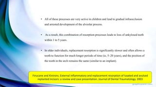 • All of these processes are very active in children and lead to gradual infraocclusion
and arrested development of the alveolar process.
• As a result, this combination of resorption processes leads to loss of ankylosed teeth
within 1 to 5 years.
• In older individuals, replacement resorption is significantly slower and often allows a
tooth to function for much longer periods of time (ie, 5–20 years), and the position of
the tooth in the arch remains the same (similar to an implant).
Finucane and Kinirons. External inflammatory and replacement resorption of luxated and avulsed
replanted incisors: a review and case presentation. Journal of Dental Traumatology. 2003
 