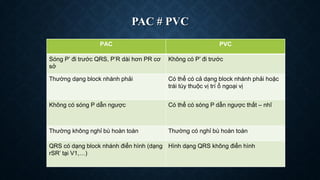 Pac Pvc Guide CHẨN ĐOÁN VÀ XỬ TRÍ NGOẠI TÂM THU | PDF
