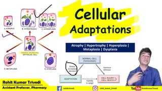 Cellular
Adaptations
Atrophy | Hypertrophy | Hyperplasia |
Metaplasia | Dysplasia
 