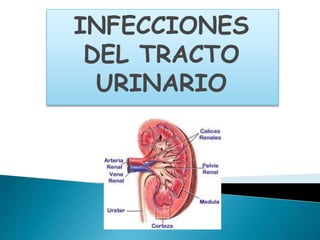 INFECCIONES
DEL TRACTO
URINARIO
 