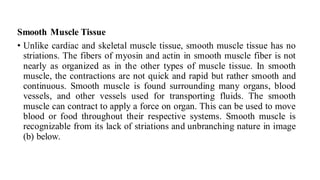 Smooth Muscle Tissue
• Unlike cardiac and skeletal muscle tissue, smooth muscle tissue has no
striations. The fibers of myosin and actin in smooth muscle fiber is not
nearly as organized as in the other types of muscle tissue. In smooth
muscle, the contractions are not quick and rapid but rather smooth and
continuous. Smooth muscle is found surrounding many organs, blood
vessels, and other vessels used for transporting fluids. The smooth
muscle can contract to apply a force on organ. This can be used to move
blood or food throughout their respective systems. Smooth muscle is
recognizable from its lack of striations and unbranching nature in image
(b) below.
 