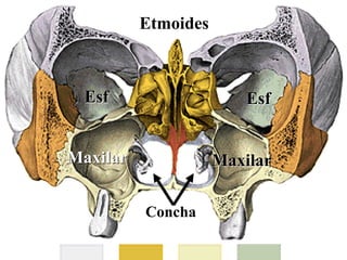 Etmoides
Esf
Esf
Maxilar
Maxilar
Concha
 