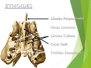 ETMOIDES
Lámina Perpendicular
Masas Laterales
Lámina Cribosa
Crista Galli
Celdillas Etmoidales
 