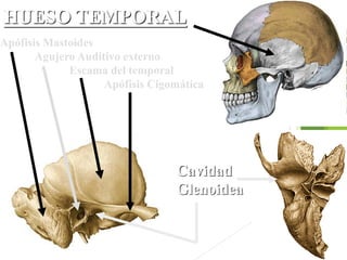HUESO TEMPORAL
Apófisis Mastoides
Agujero Auditivo externo
Escama del temporal
Apófisis Cigomática
Cavidad
Glenoidea
 