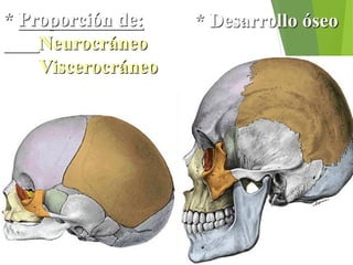* Proporción de:
Neurocráneo
Viscerocráneo
* Desarrollo óseo
 