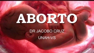 ABORTO
DR JACOBO CRUZ
UNAH-VS
 