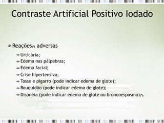 Contraste Artificial Positivo Iodado
Reações(*) adversas
Urticária;
Edema nas pálpebras;
Edema facial;
Crise hipertensiva;
Tosse e pigarro (pode indicar edema de glote);
Rouquidão (pode indicar edema de glote);
Dispnéia (pode indicar edema de glote ou broncoespasmo)(*).
 