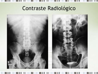 Contraste Radiológico
 