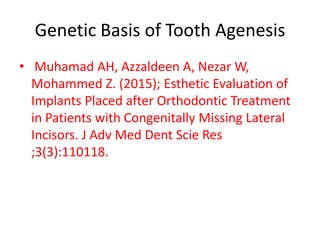 Genetic Basis of Tooth Agenesis
• Muhamad AH, Azzaldeen A, Nezar W,
Mohammed Z. (2015); Esthetic Evaluation of
Implants Placed after Orthodontic Treatment
in Patients with Congenitally Missing Lateral
Incisors. J Adv Med Dent Scie Res
;3(3):110118.
 