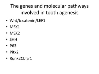 The genes and molecular pathways
involved in tooth agenesis
• Wnt/b catenin/LEF1
• MSX1
• MSX2
• SHH
• P63
• Pitx2
• Runx2Cbfa 1
 