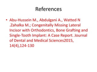 References
• Abu-Hussein M., Abdulgani A., Watted N
.Zahalka M.; Congenitally Missing Lateral
Incisor with Orthodontics, Bone Grafting and
Single-Tooth Implant: A Case Report. Journal
of Dental and Medical Sciences2015,
14(4),124-130
 