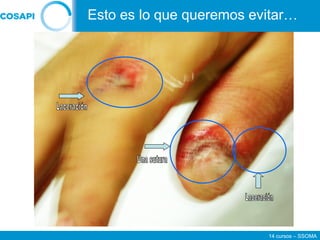 14 cursos – SSOMA
Esto es lo que queremos evitar…
 