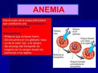 ANEMIA
Disminución de la masa eritrocitaria
que condiciona una concentración
baja de hemoglobina.
Hemoglobina:
- Proteína que contiene hierro.
- Se encuentra en los glóbulos rojos.
- Le da el color rojo a la sangre.
- Se encarga del transporte de
oxígeno por la sangre desde los
pulmones a los tejidos.
 