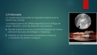 c) Endoscopia:
La nasolaringoscopia evalúa la integridad anatómica de la
hipofaringe y laringe.
La esofagoscopia es de utilidad diagnóstica en la disfagia de
origen mecánico, como las estenosis o los tumores.
 Permite evaluar la mucosa y la toma de biopsias de manera
directa en los casos de esofagitis o neoplasias.
 Además, es una herramienta terapéutica e incluye la
o colocación de prótesis esofágicas.
 