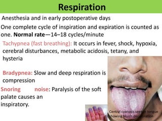 Respiration
Anesthesia and in early postoperative days
One complete cycle of inspiration and expiration is counted as
one....