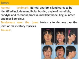 Jaws
Normal landmark: Normal anatomic landmarks to be
identified include mandibular border, angle of mandible,
condyle and...