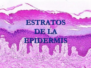 ESTRATOS
DE LA
EPIDERMIS
 