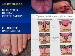 APLICABILIDAD
DERMATITIS
HERIDAS
CICATRIZACIÓN
FOLICULITIS
ONICOMICOSIS
 