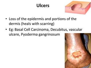 Pyoderma Leg Ulcer 2. Approach to dermatologic diagnosis.pptx