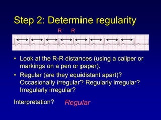 2.How to analyze a rhythm.ppt