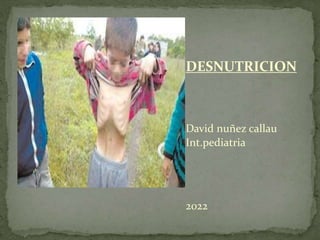 
DESNUTRICION
David nuñez callau
Int.pediatria
2022
 