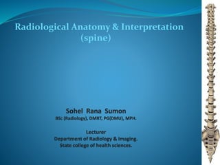 Radiological Anatomy & Interpretation
(spine)
 
