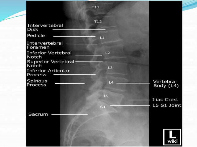 Radiological anatomy-spine.pdf