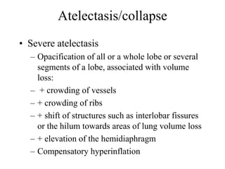 Atelectasis/collapse
• Severe atelectasis
– Opacification of all or a whole lobe or several
segments of a lobe, associated with volume
loss:
– + crowding of vessels
– + crowding of ribs
– + shift of structures such as interlobar fissures
or the hilum towards areas of lung volume loss
– + elevation of the hemidiaphragm
– Compensatory hyperinflation
 