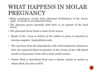 2. ECTOPIC & MOLAR PREGNANCY.pptx