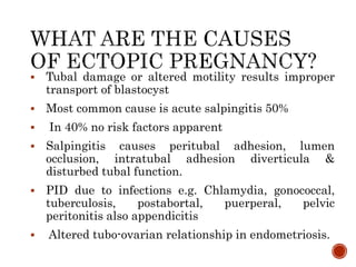 2. ECTOPIC & MOLAR PREGNANCY.pptx