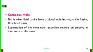 • Corneous mole
• This is when fluid drains from a blood mole leaving a the fleshy,
firm, hard mass.
• Examination of the ...