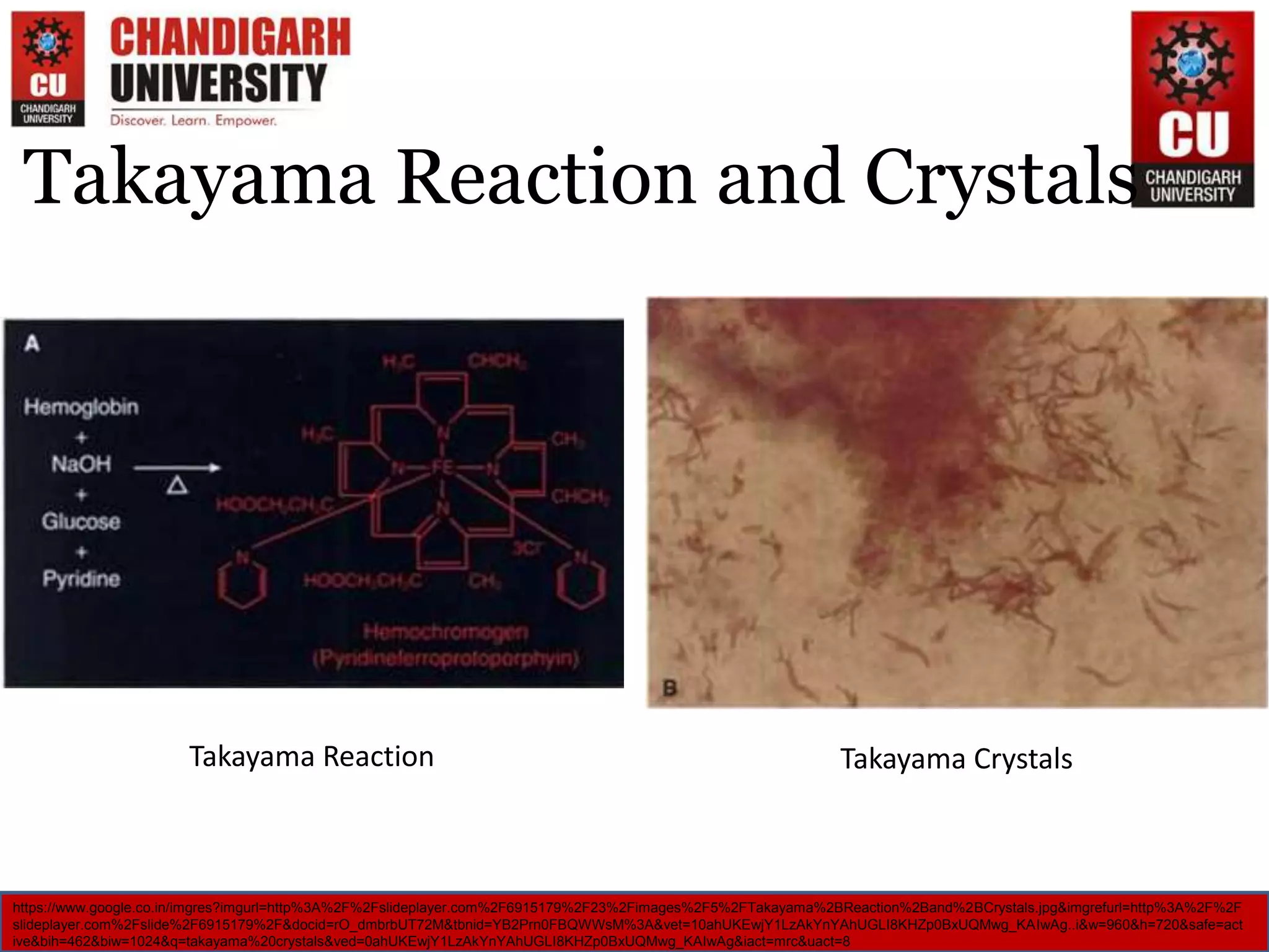 Takayama Reaction and Crystals
Takayama Reaction Takayama Crystals
https://www.google.co.in/imgres?imgurl=http%3A%2F%2Fslideplayer.com%2F6915179%2F23%2Fimages%2F5%2FTakayama%2BReaction%2Band%2BCrystals.jpg&imgrefurl=http%3A%2F%2F
slideplayer.com%2Fslide%2F6915179%2F&docid=rO_dmbrbUT72M&tbnid=YB2Prn0FBQWWsM%3A&vet=10ahUKEwjY1LzAkYnYAhUGLI8KHZp0BxUQMwg_KAIwAg..i&w=960&h=720&safe=act
ive&bih=462&biw=1024&q=takayama%20crystals&ved=0ahUKEwjY1LzAkYnYAhUGLI8KHZp0BxUQMwg_KAIwAg&iact=mrc&uact=8
 