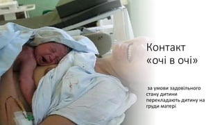 Контакт
«очі в очі»
за умови задовільного
стану дитини
перекладають дитину на
груди матері
 