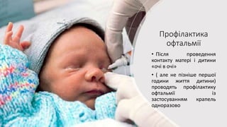 Профілактика
офтальмії
• Після проведення
контакту матері і дитини
«очі в очі»
• ( але не пізніше першої
години життя дитини)
проводять профілактику
офтальмії із
застосуванням крапель
одноразово
 