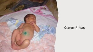 Статевий криз
 