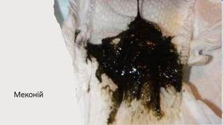 Меконій
 