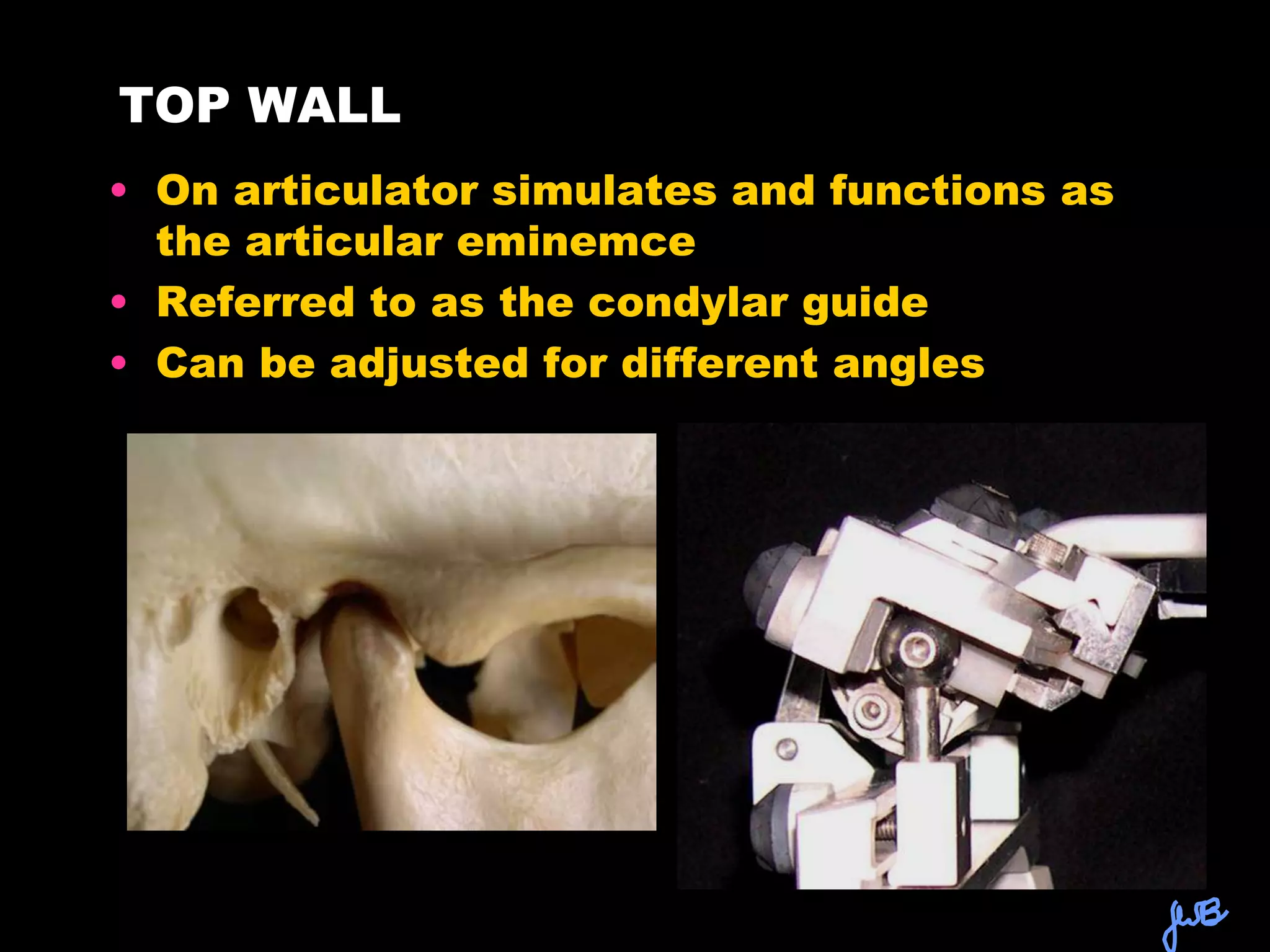 zTHE DENTAL ARTICULATOR.ppt
