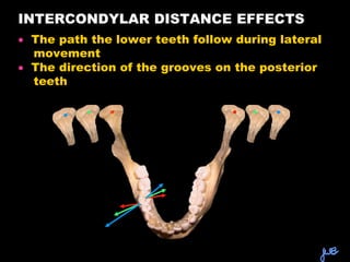 Intercondylar Distance Brain zTHE DENTAL ARTICULATOR.ppt