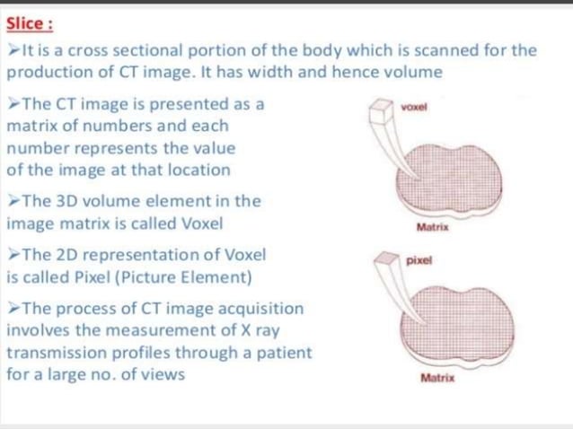 2.pptx development of ct | PPT