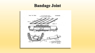 Bandage Joint
 