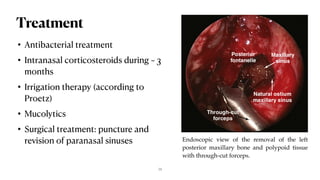 2. Sinuses Pathology 21-22 (1).pdf