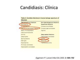 Candidiasis: Clínica
Eggimann P, Lancet Infect Dis 2003; 3: 685–702
 