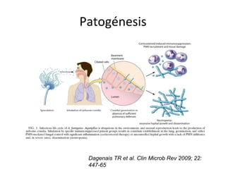 Patogénesis
Dagenais TR et al. Clin Microb Rev 2009; 22:
447-65
 