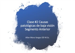 Clase #2 Causas
patológicas de baja visión
Segmento Anterior
Allan Mora Vargas OD M.Sc.
 