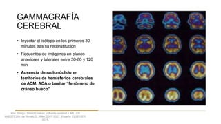 GAMMAGRAFÍA
CEREBRAL
• Inyectar el isótopo en los primeros 30
minutos tras su reconstitución
• Recuentos de imágenes en planos
anteriores y laterales entre 30-60 y 120
min
• Ausencia de radionúclido en
territorios de hemisferios cerebrales
de ACM, ACA o basilar “fenómeno de
cráneo hueco”
Kho Shingu, Shinichi nakao. «Muerte cerebral.» MILLER
ANESTESIA, de Ronald D. Miller, 2307-2327. España: ELSEVIER,
2015.
 