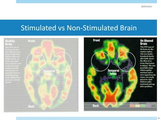 Stimulated vs Non-Stimulated Brain
29/05/2023
88
 