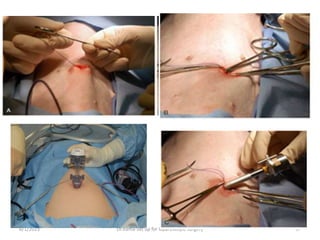 6/1/2023 Dr.Rama-Set up for laparoscopic surgery 37
 
