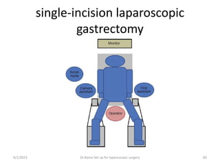 single-incision laparoscopic
gastrectomy
6/1/2023 Dr.Rama-Set up for laparoscopic surgery 83
 